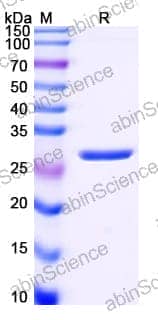 Recombinant Human PSA/KLK3 Protein, N-His