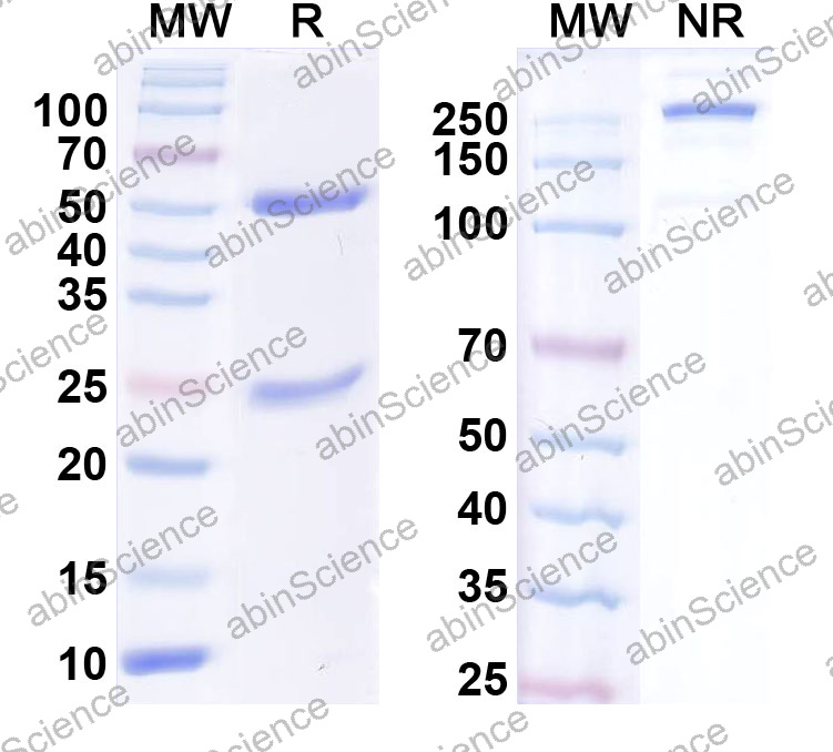 Anti-Human PSA/KLK3 Monoclonal Antibody (1A554)