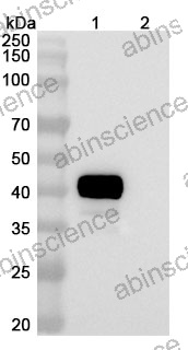 InVivoMAb Anti-Human ERBB2/HER-2 & CD3e Bispecific Antibody (Iv0231)