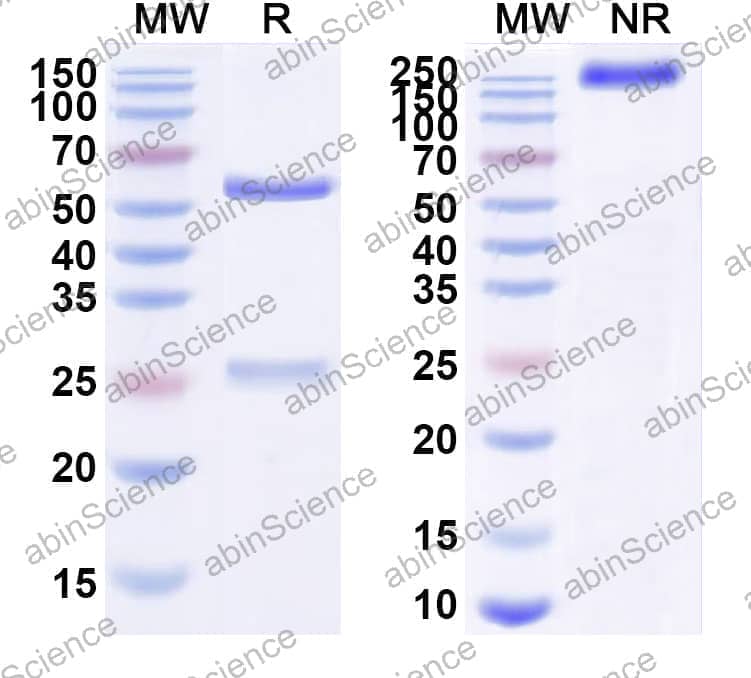 Research Grade Anti-Human CD340/ERBB2/HER2/NEU (ZV0201)