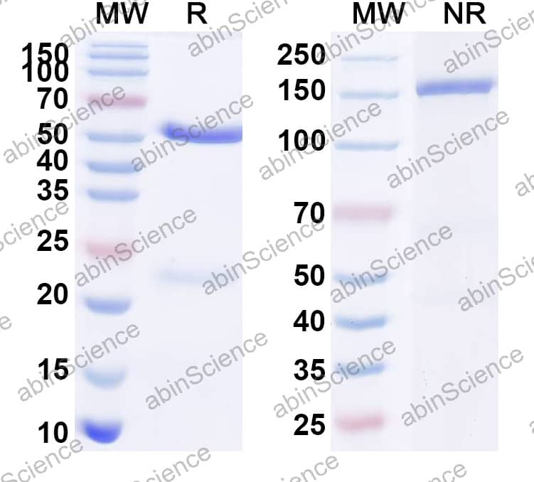 Anti-Human CD56/NCAM1 Recombinant Antibody (N901)