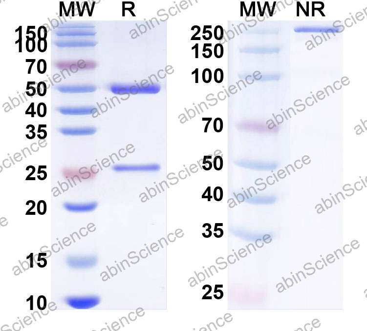 Anti-Human KRT5 Monoclonal Antibody (1A528)