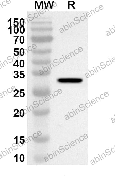 Anti-ESR1/ER-alpha Polyclonal Antibody