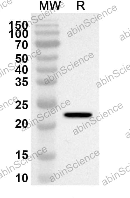 Anti-ESR1/ER-alpha Polyclonal Antibody