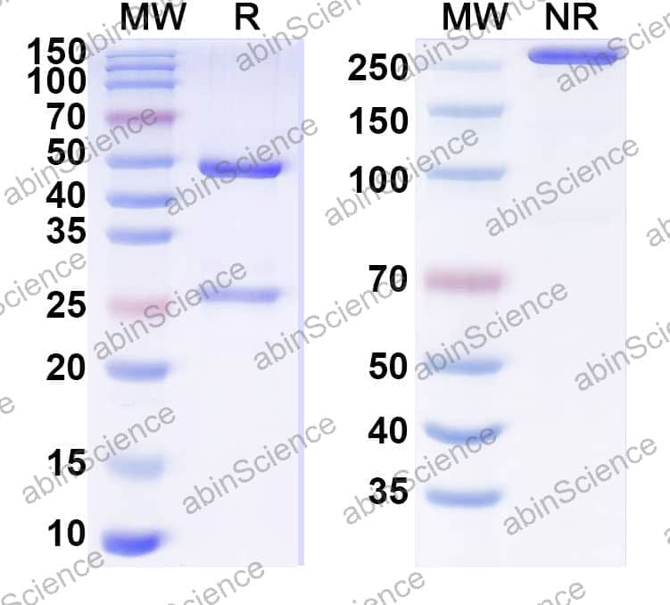 Anti-Human TFPI Recombinant Antibody (SAA2013)