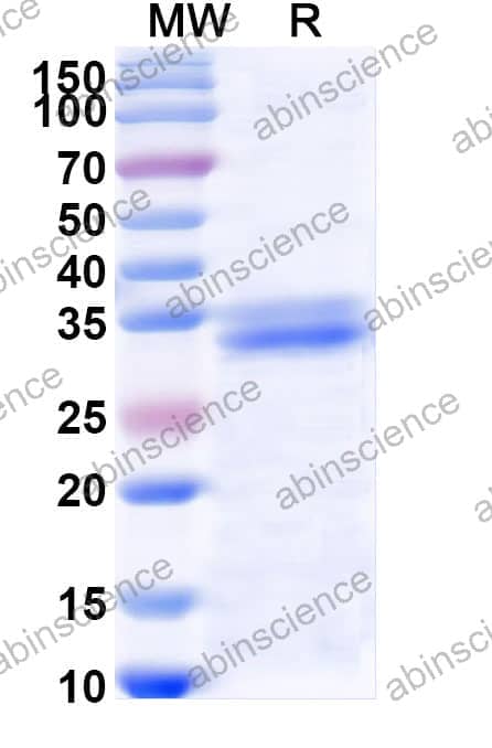 Recombinant Human CD28 Protein, C-His