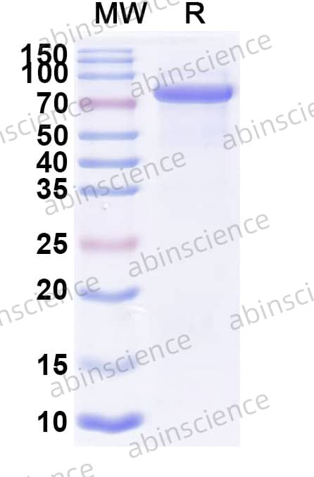 Recombinant Human CD324/CDH1 Protein, C-His