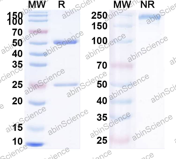 Anti-Human APC/Activated protein C Antibody (C25k23)