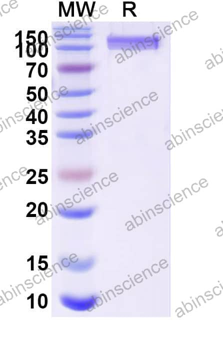 Recombinant Human CD42b/GP1BA Protein, C-Fc