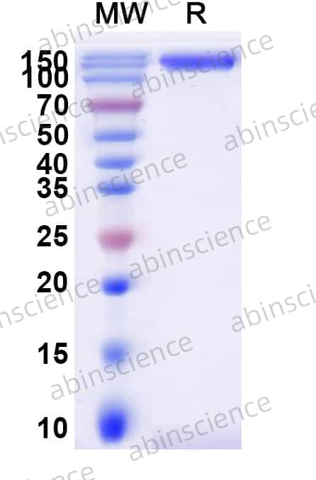 Recombinant Human CD66e/CEACAM5 Protein, C-Fc