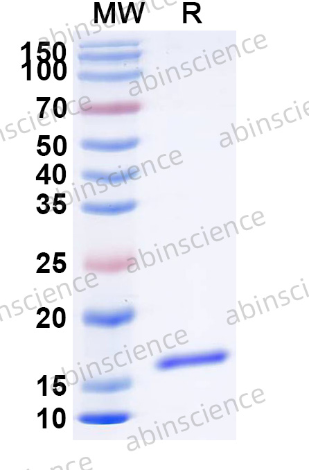 Anti-Human CD66e/CEA/CEACAM5 Nanobody (C43)