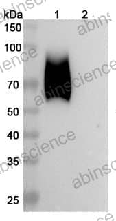 Recombinant Human CD66a/CEACAM1 Protein, C-His