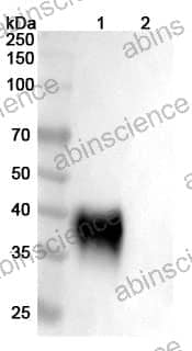Recombinant Human CD48 Protein, C-His