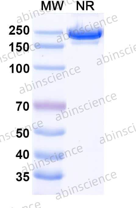 Anti-Human CD126/IL6R/IL-6RA Antibody (SAA0049)