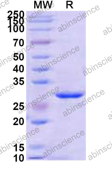 Recombinant Streptomyces plicatus Endo H Protein, N-His