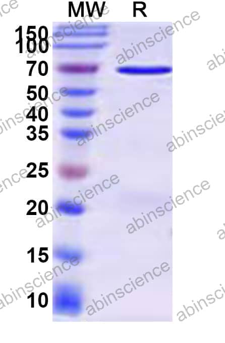 Recombinant Streptococcus pseudoporcinus IgdE2 Protein, N-GST & C-His
