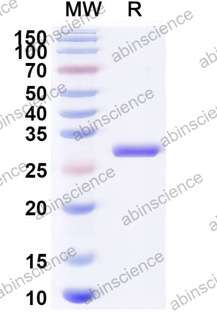 Recombinant Staphylococcus aureus entA/SEA Protein, N-His