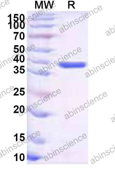 Recombinant Pseudomonas fluorescens AlkC Protein, N-His