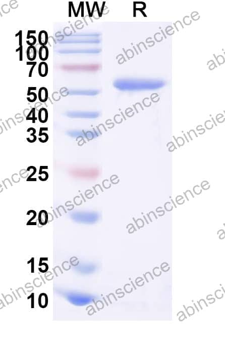 Recombinant Haemophilus influenzae Hia5 Protein, N-His