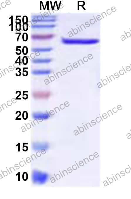 Recombinant Pseudomonas fluorescens PhoX Protein, N-His