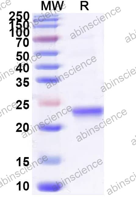 Recombinant Asp f 2 Protein, N-His