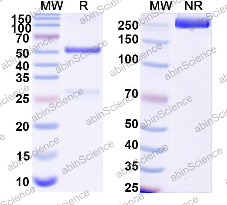 Anti-Plasmodium vivax RBP2b Antibody (SAA2534)