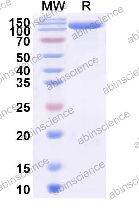 Recombinant Haemophilus influenzae IgaB1 Protein, N-GST