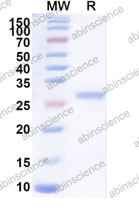Recombinant Mycoplasma pneumoniae mgpA/Adhesin P1 Protein, N-His