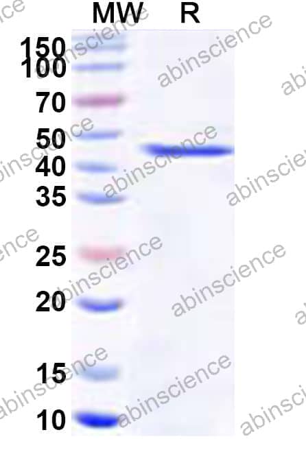 Recombinant Pseudomonas fluorescens kynU/Kynureninase Protein, N-His