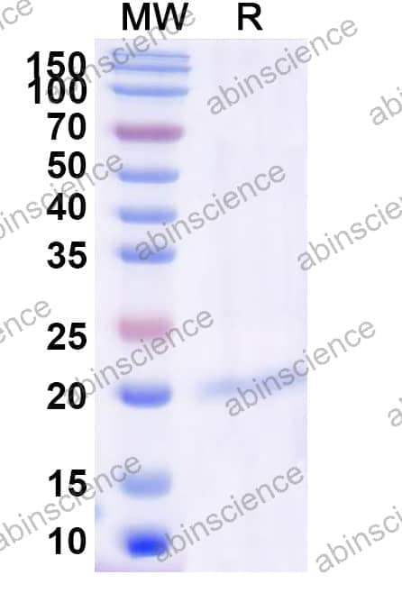 Recombinant Streptococcus pyogenes M protein Protein, N-His