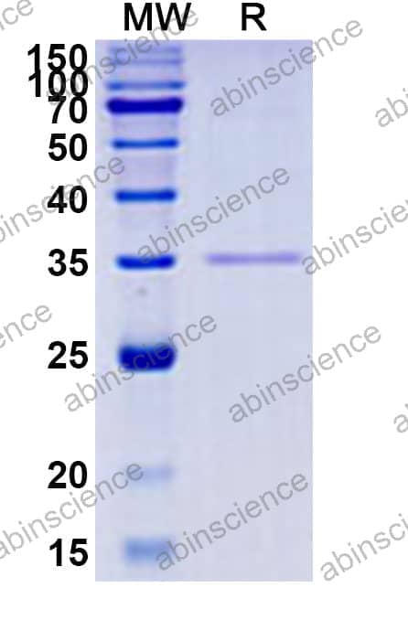 Recombinant Toxoplasma gondii SAG1/Major surface antigen p30 Protein, N-His-SUMO