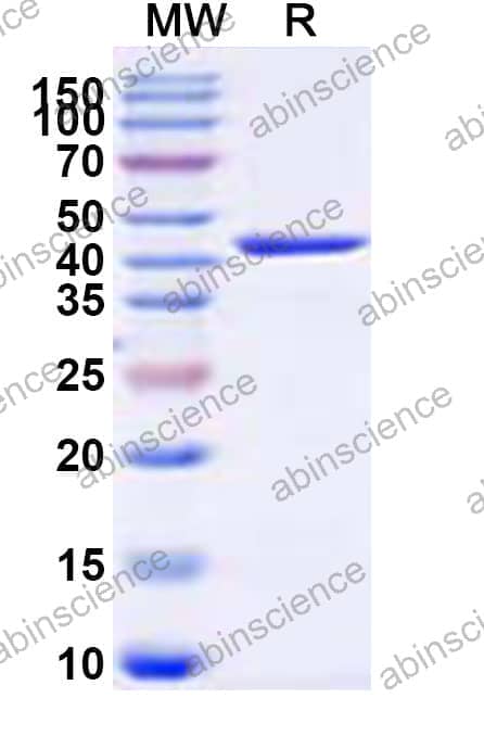 Recombinant Streptococcus dysgalactiae SKC-2 Protein, N-His