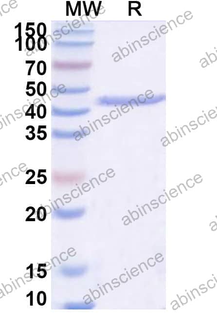 Recombinant Treponema pallidum FlaB3 Protein, N-His-SUMO