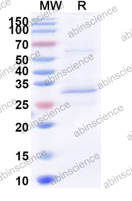 Recombinant Clostridium perfringens toxin NetB Protein, N-His