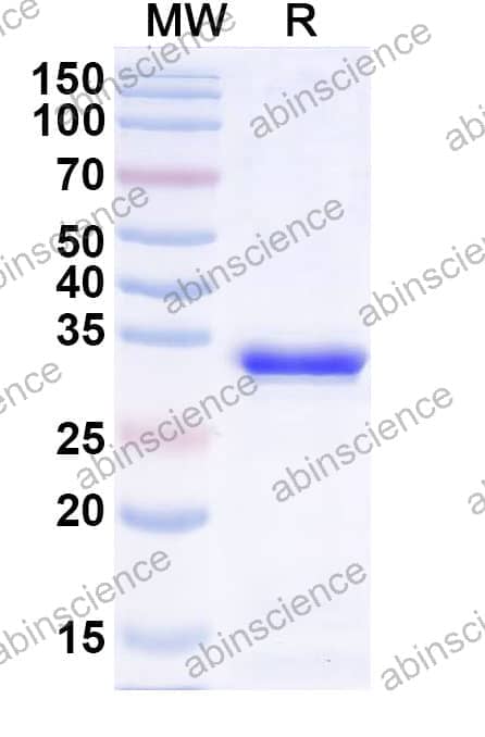 Recombinant Clostridium perfringens toxin NetB Protein, N-His
