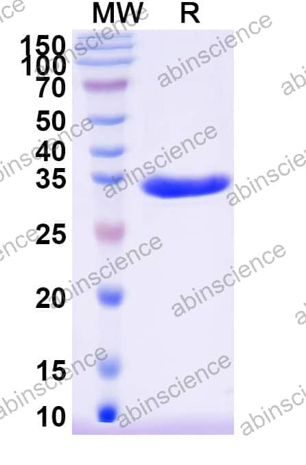 Recombinant Haemophilus influenzae SEL1-like repeat protein Protein, N-His