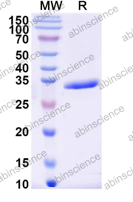 Recombinant Haemophilus influenzae SEL1-like repeat protein Protein, N-His