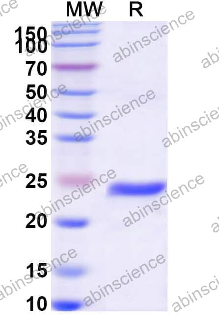 Recombinant Mouse FGF15 Protein, N-His