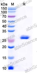 Recombinant Mouse Mcpt1 Protein, N-His