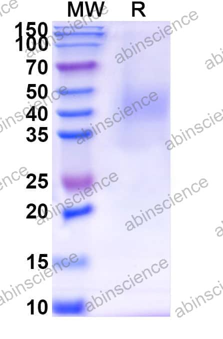 Recombinant Mouse CD30/TNFRSF8 Protein, C-His