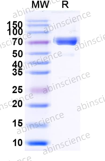 Recombinant Mouse ERBB3/HER3 Protein, C-His