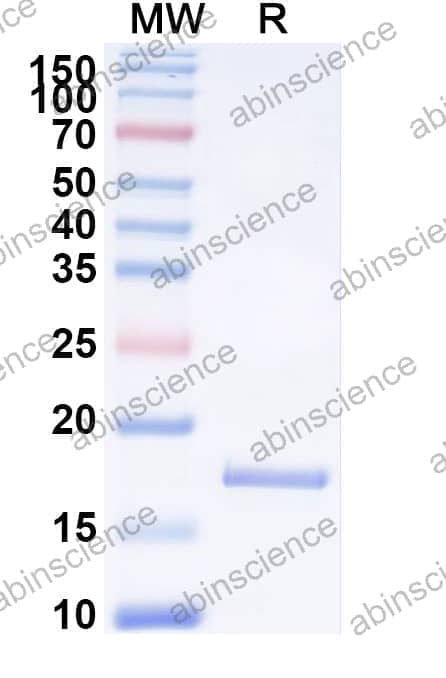 Recombinant Mouse CD314/KLRK1/NKG2D Protein, N-His