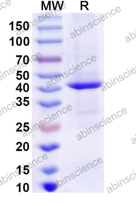 Recombinant Mouse IL12B/IL-12 p40/NKSF2 Protein, C-Strep