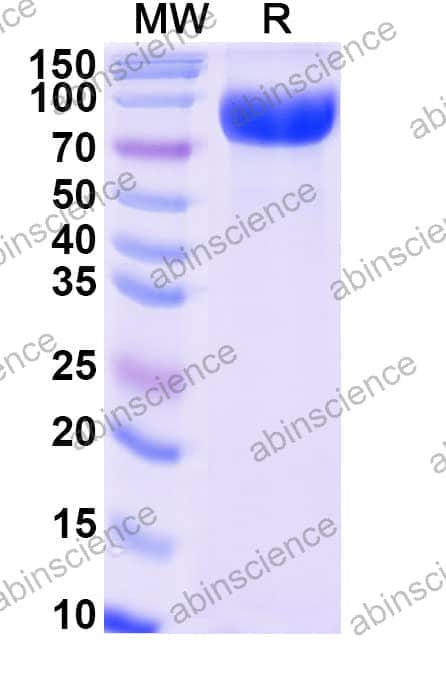 Recombinant Mouse CD62E/SELE Protein, C-His