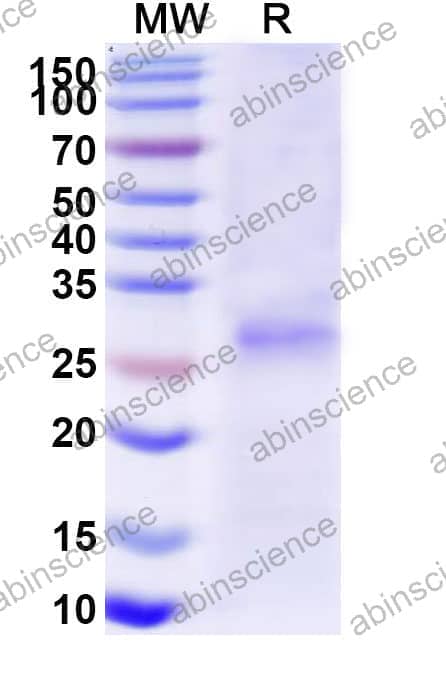 Recombinant Mouse IL12A/IL-12 p35/NKSF1 Protein, C-His