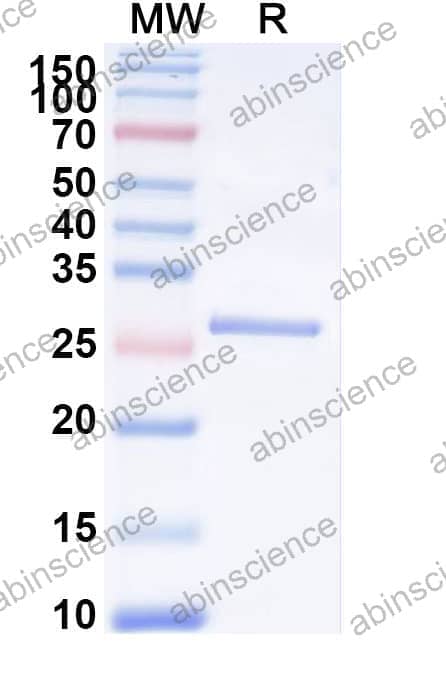 Recombinant Mouse NGF/Beta-NGF Protein, N-His