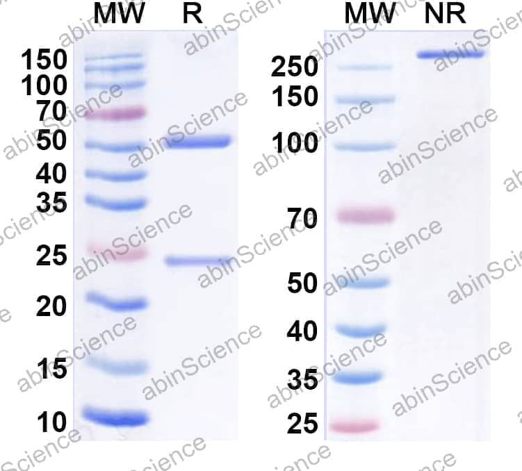 Anti-Mouse TIMD4/TIM-4 Recombinant Antibody (RMT4-53)