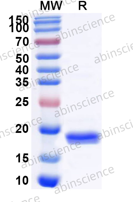 Recombinant Mouse CD279/PDCD1/PD1 Protein, N-His