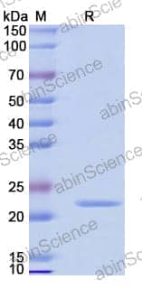 Recombinant Mouse IL28B/IL28C/IFNL3 Protein, N-His