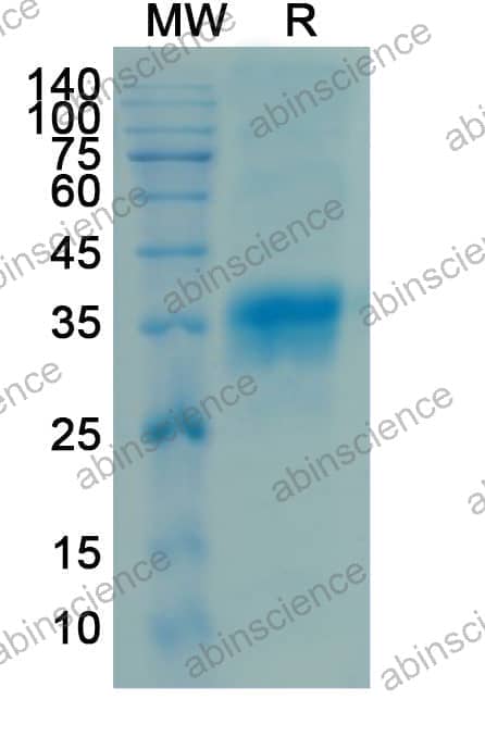 Recombinant Mouse IL34 Protein, C-His